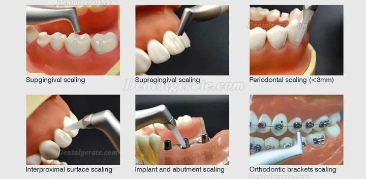VolDent AirJet2S dentale airflow pulver (supragingival + supragingivales handst&uuml;ck)